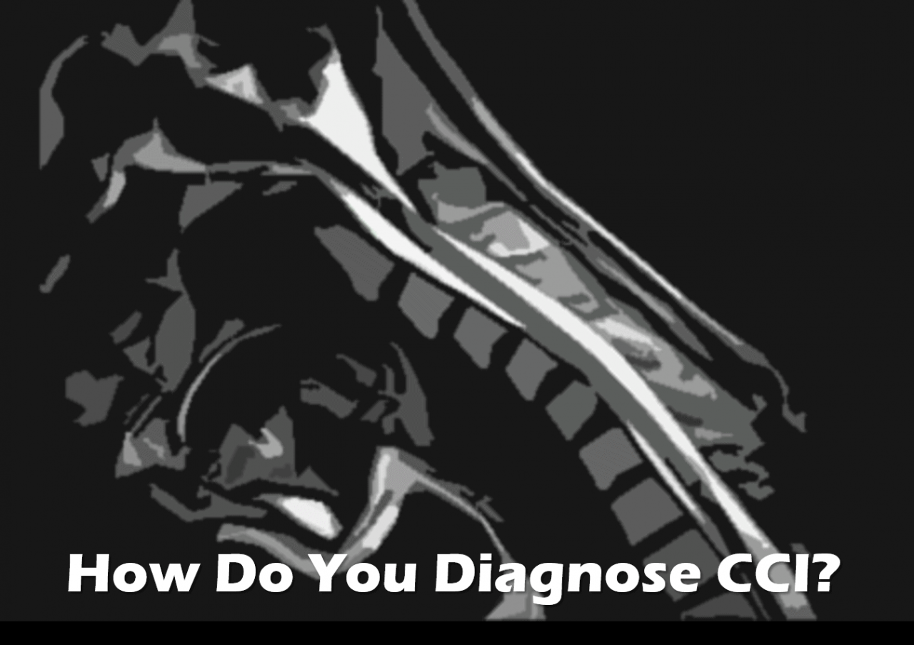 how do you diagnose cci