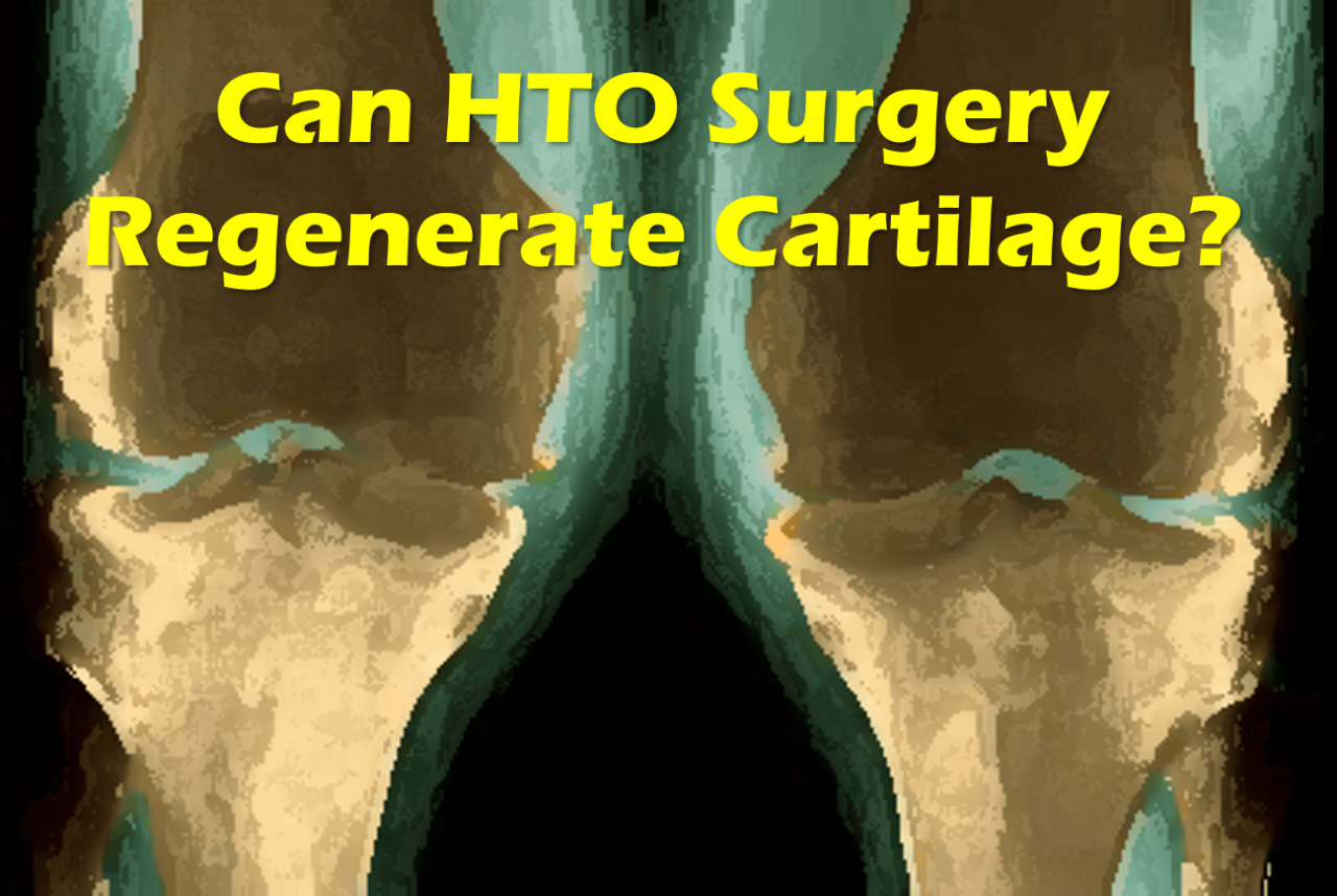 hto surgery cartilage regeneration