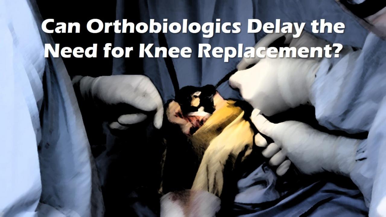 delaying a knee replacement
